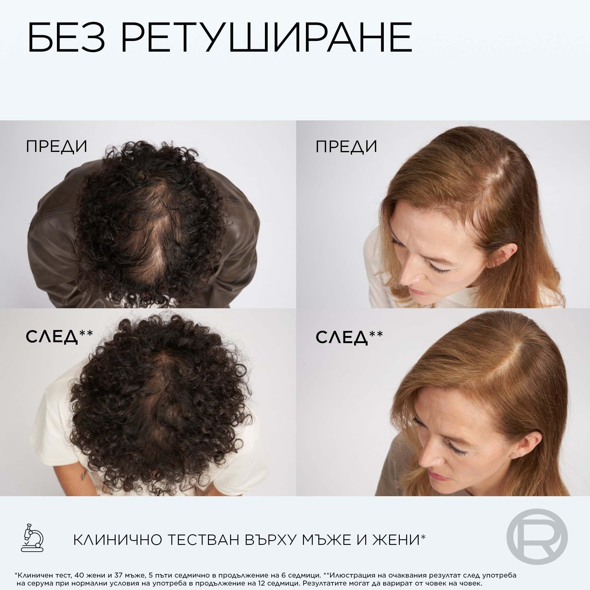 L'Oreal Paris Elseve Growth Booster Scalp Serum Серум против косопад