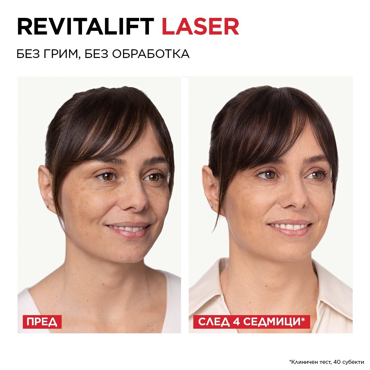 L\'Oréal  DERMO REVITALIFT LASER X3 Крем за лице 50мл