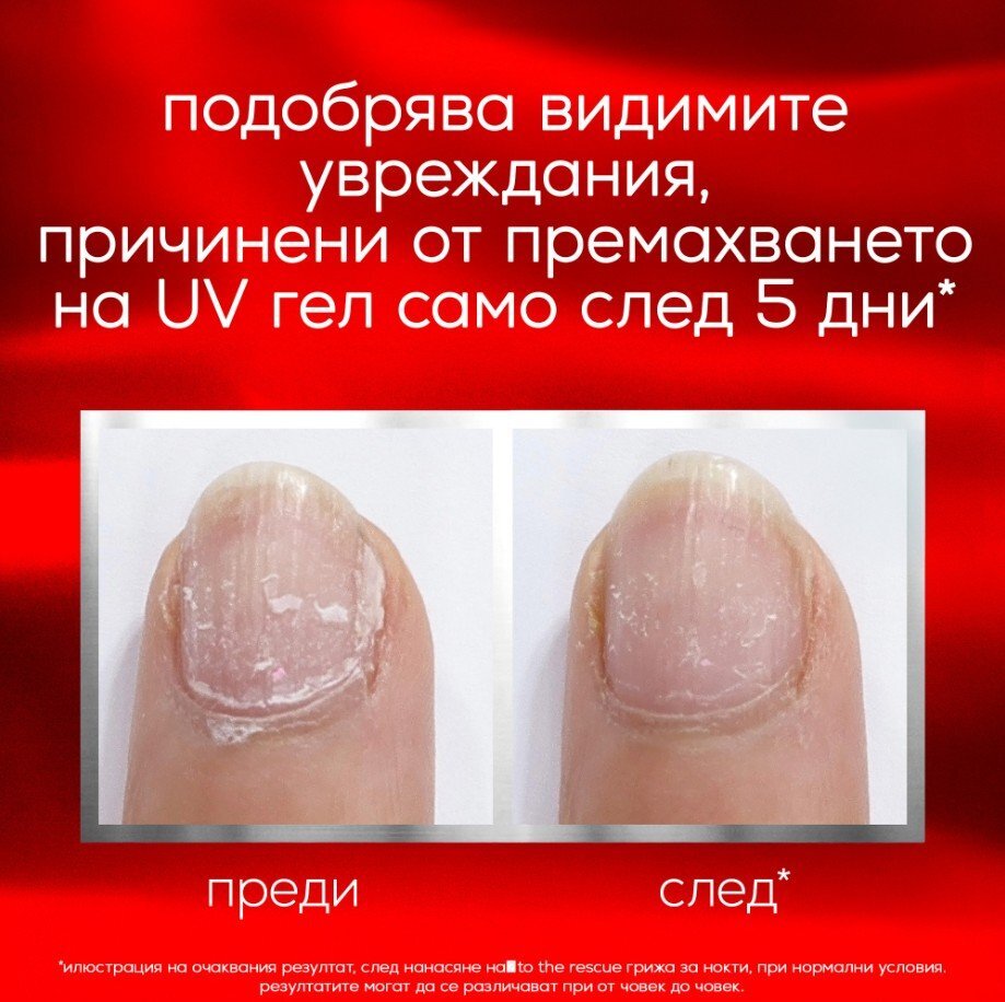 Essie To The Rescue Nail Repair Заздравител за нокти