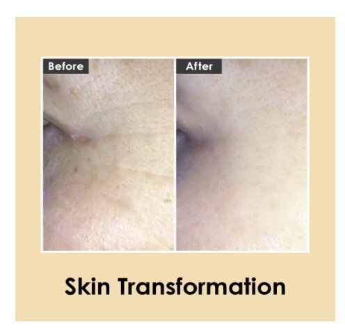 Medi-Peel Hyaluronic Volumizing Eye Cream Околоочен крем