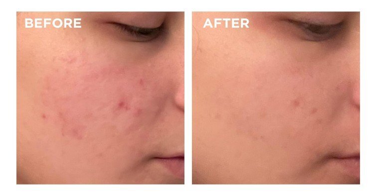 Clarins Beauty Flash Peel Изглаждащ пилинг за лице за мигновено изглаждане и подхранване