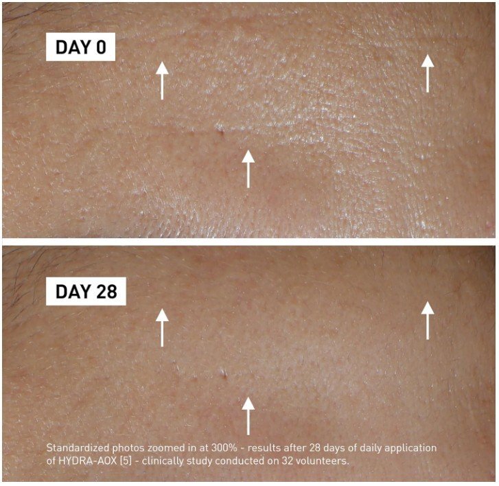 Filorga Hydra Aox 5 Intensive Antioxidant Serum Интензивен антиоксидантен серум за лице