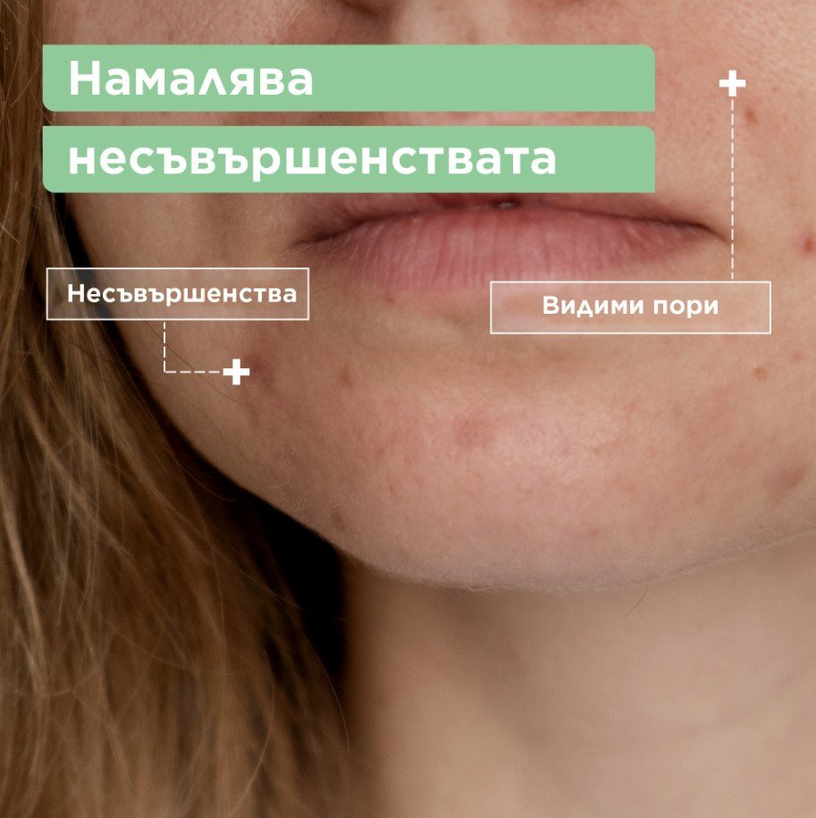 Mixa Почистващ гел за лице против несъвършенства