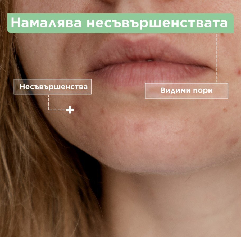 Mixa Флуид против несъвършенства
