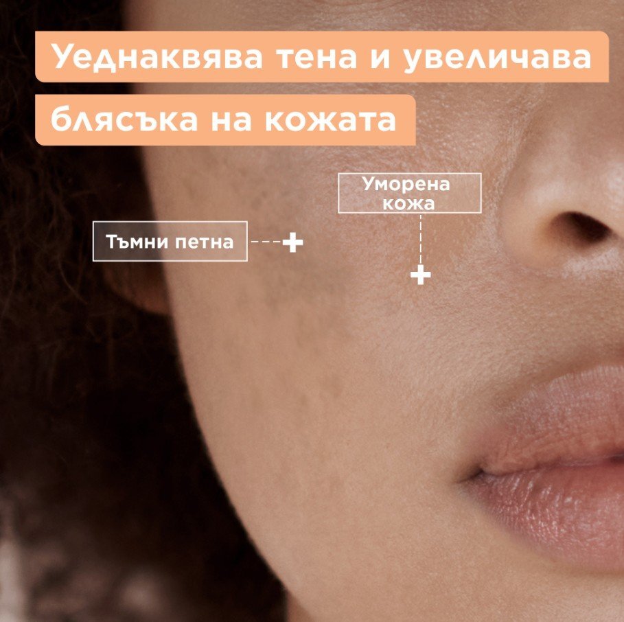 MIXA Флуид против тъмни петна