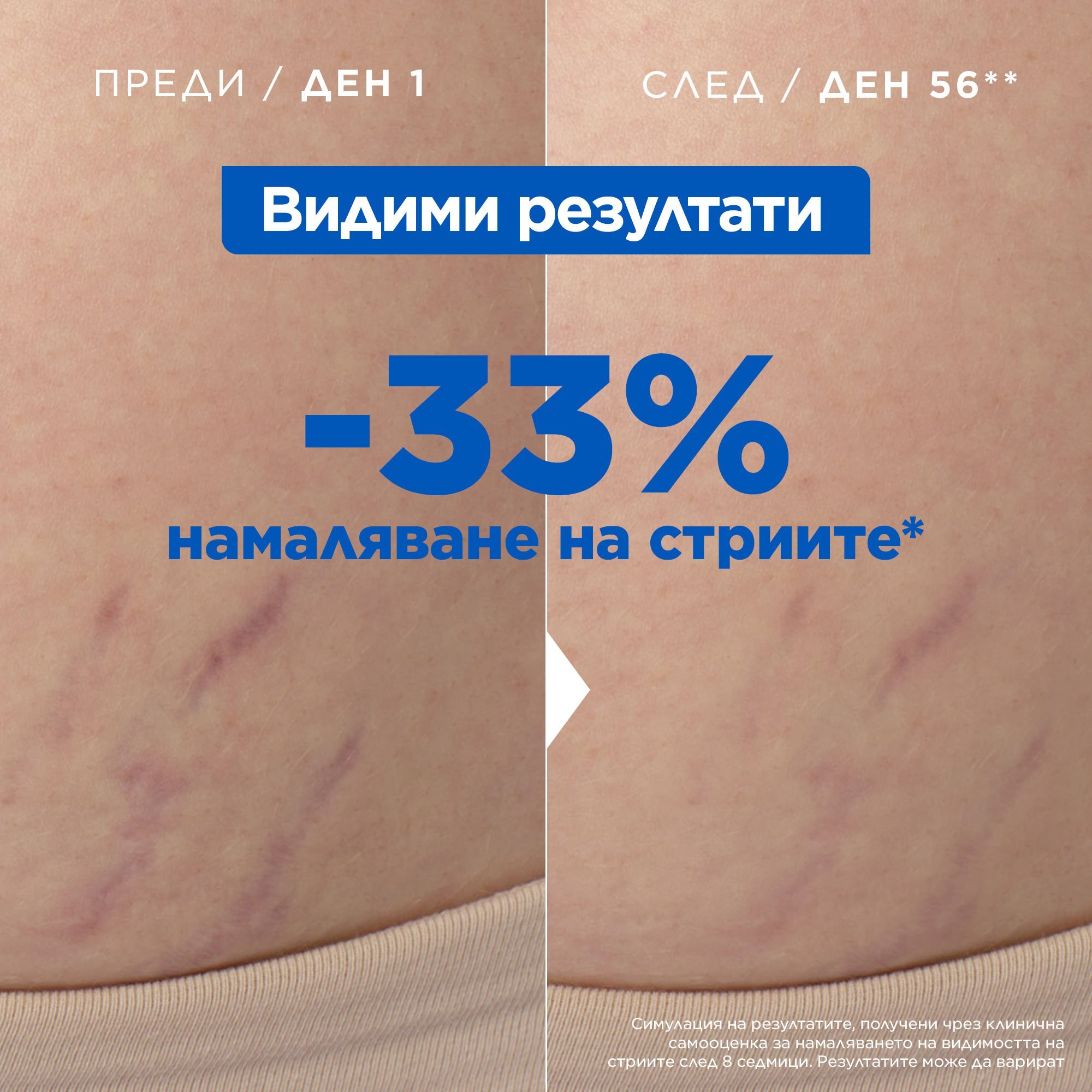 Mixa Масло против стрии