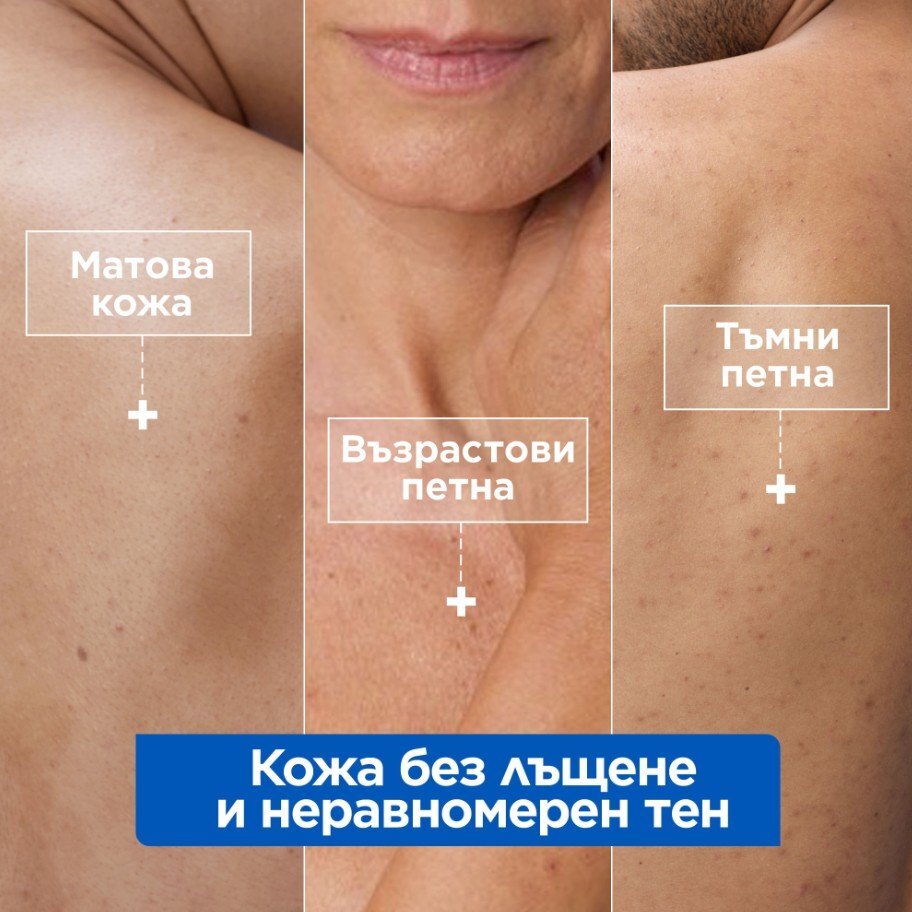 Mixa Niacinamid xидратиращ крем срещу тъмни петна