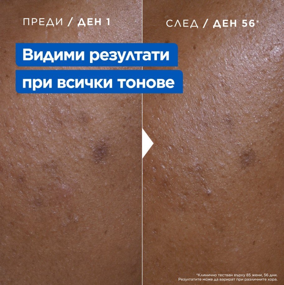 Mixa Niacinamid xидратиращ крем срещу тъмни петна