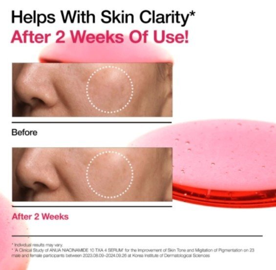 Anua Niacinamide 10% + TXA 4% Serum Серум за лице