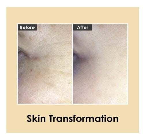 Medi-Peel Hyaluronic Volumizing Eye Cream Околоочен крем