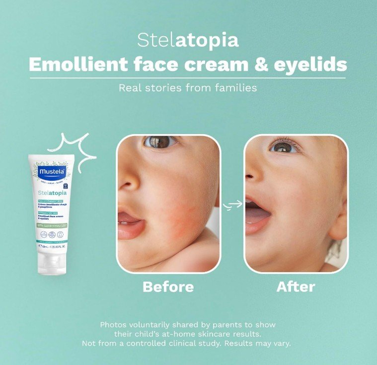 Mustela Stelatopia Крем за лице и клепачи